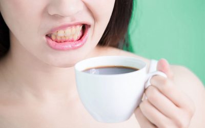 Alimentos que manchan los dientes