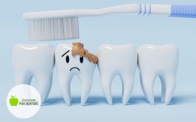 Causas de las caries dentales