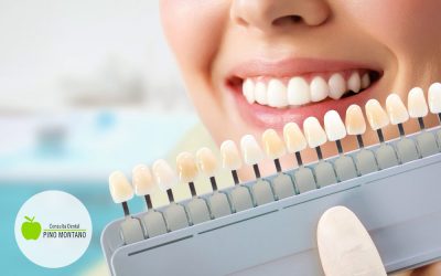 Blanqueamiento dental. Tratamientos y cuidados