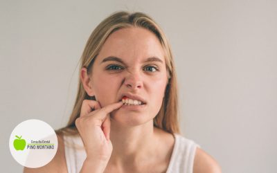 Sintomas piorrea dental