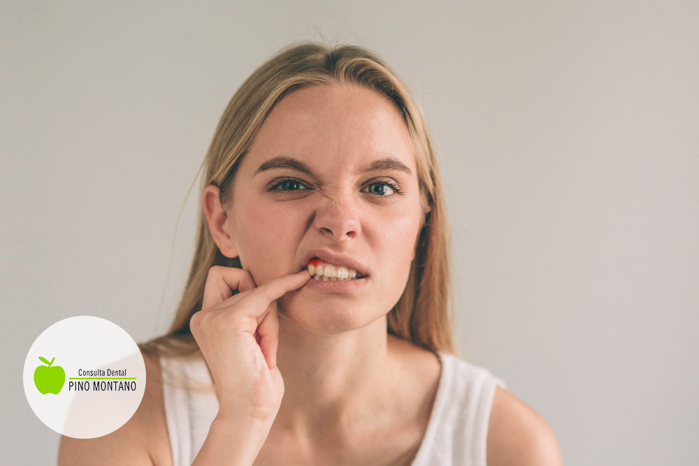 Sintomas piorrea dental