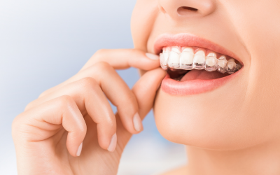 ¿Cuándo se puede usar la ortodoncia invisible?