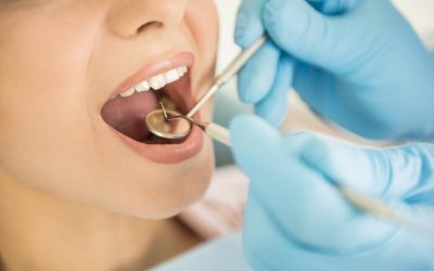 Consejos tras una extracción dental