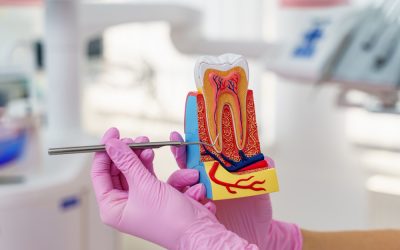 ¿Cómo se hace una endodoncia?